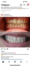 Load image into Gallery viewer, Pre-Recorded Teeth Whitening
